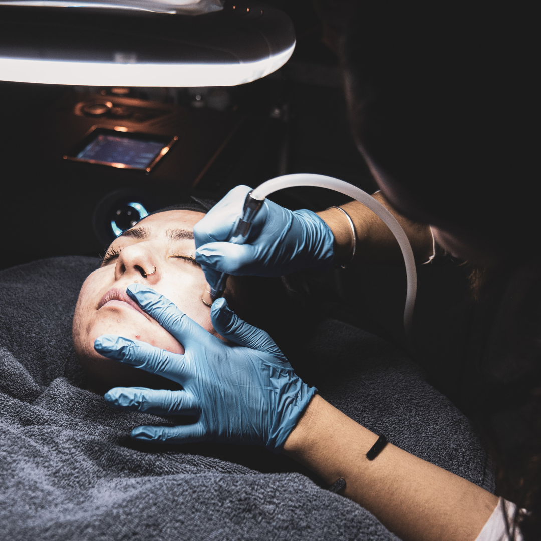 Microdermabrasion