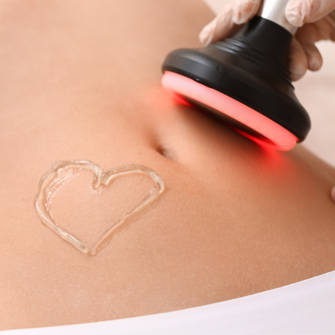 Cavitation And Radiofrequency (Single Session)