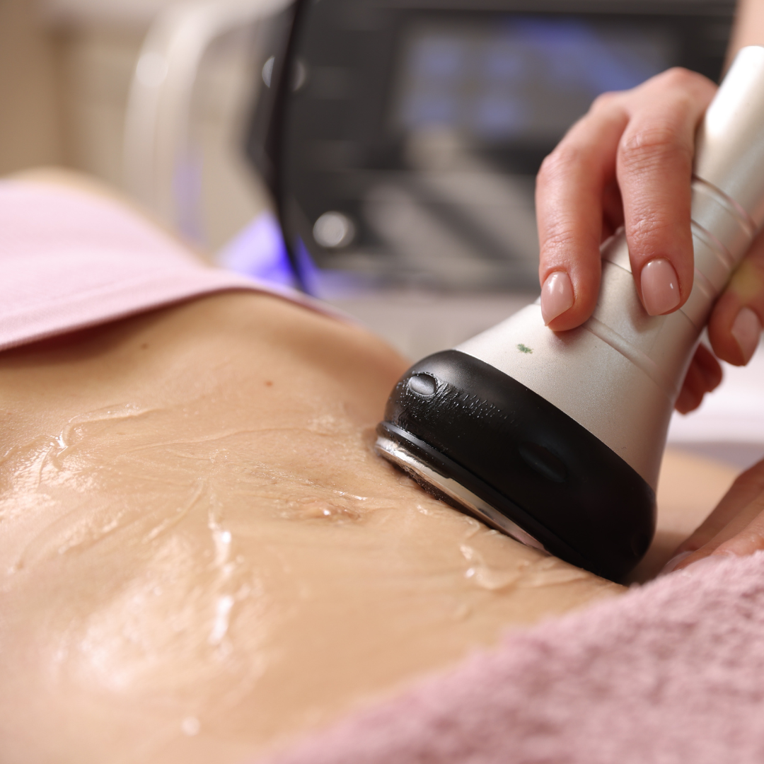 Cavitation And Radiofrequency (Single Session)