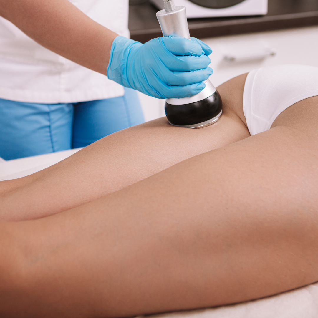 Cavitation or Radiofrequency