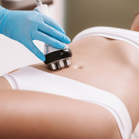 Cavitation or Radiofrequency